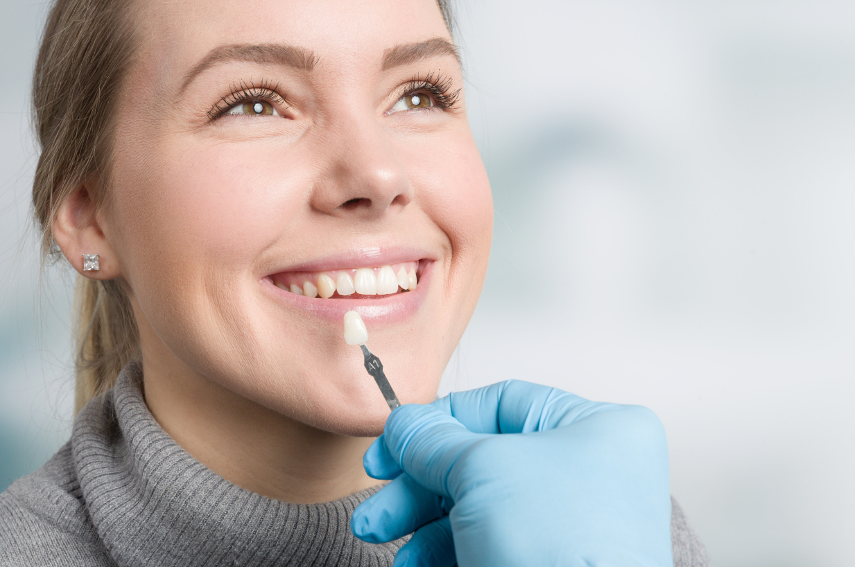 Dental Veneers Can Transform and Rejuvenate Your Smile 