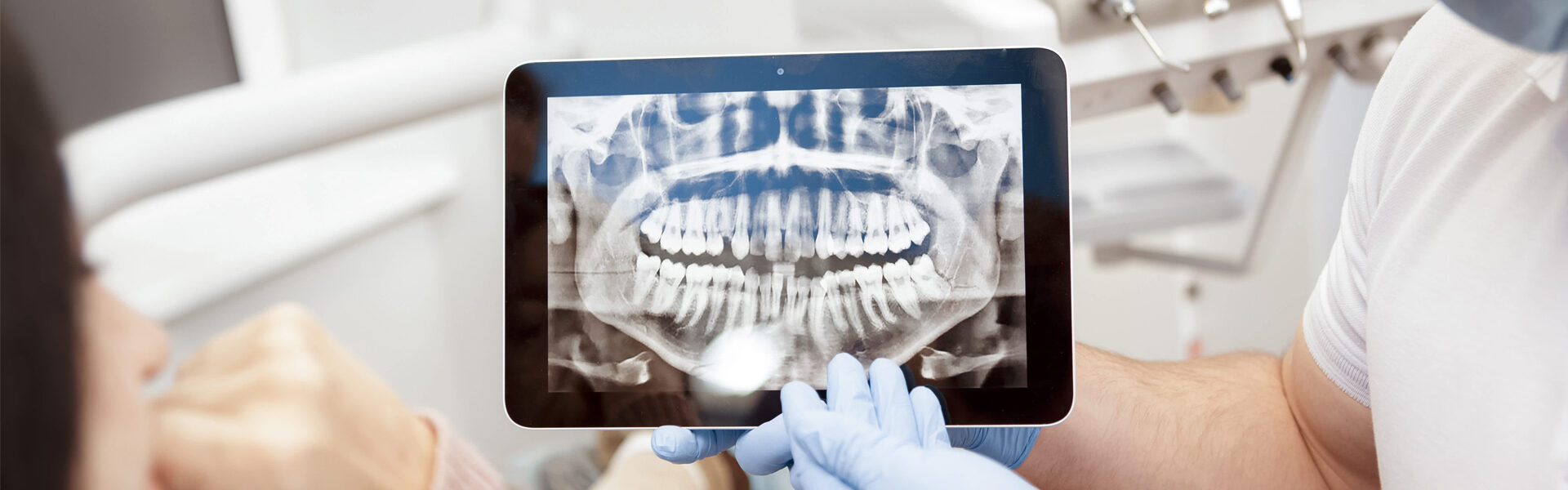 Low Radiation Dental X-Rays in Andover, MA