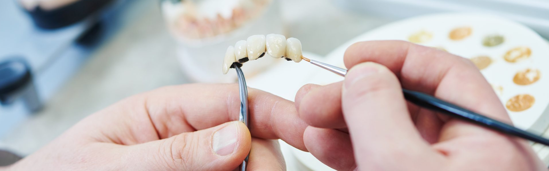 Prosthodontics in Andover, MA Dental Office in Andover